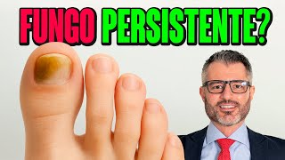 Não consegue eliminar o fungo da unha? Descubra o motivo.