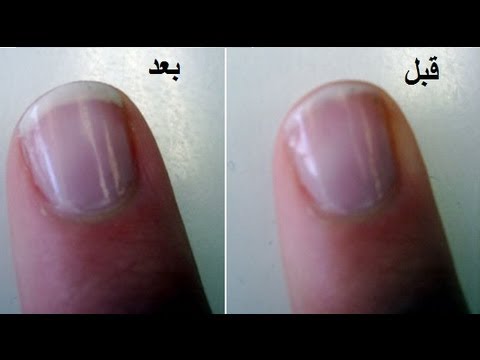 طريقة سهلة لتطويل الاظافر وازالة الاصفرار وجعلها صحية وقوية وجميلة