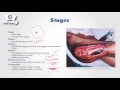 Pressure Ulcers and Their Management