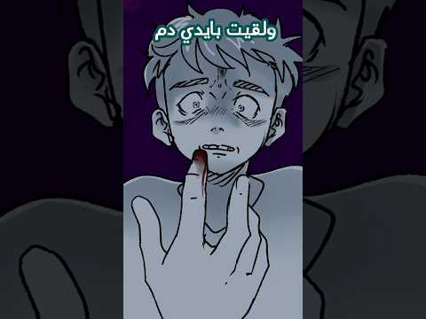 كان رح يجيلي سرطان 😨