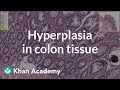 Understanding Colon Pathology