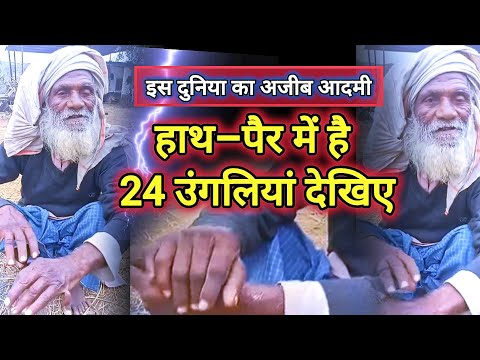 आखिर.. मिल गया 24 उंगली वाला आदमी #ajabgajab #ajooba #facts #viralman #viralshort #trendingnews #yt