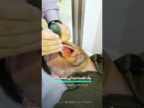 ✅ عدد ۱۴ رو کامنت کنید تا  برای شروع مسیر درمان کنارتون باشیم ✅