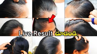 తెల్లజుట్టు నిమిషాల్లో నల్లగా ఎలా మారిందో Live రిసల్ట్ చూడండి 😍ఒక్కసారికే షాక్ ఇచ్చే ఫలితం!"👌