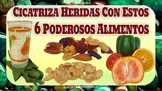 Cicatriza Tus Heridas Rápidamente con Estos 6 Poderosos Alimentos