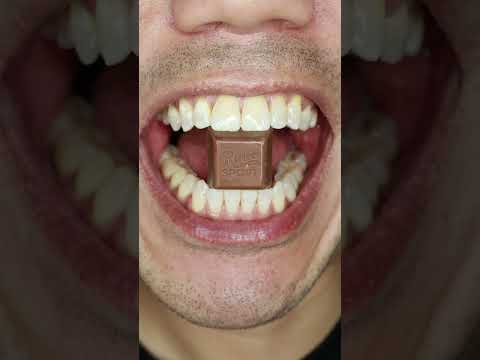 Gracias ๐ธ| Ritter SPORT Cubes Thank You Chocolate ๐ซ #DoctorTristanPeh #ASMR #shorts