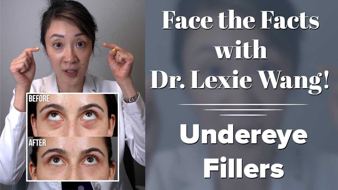 Dr. Lexie Wang discussing under-eye fillers.