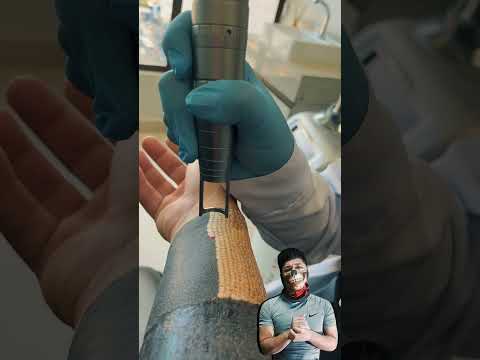 Quieres Borrar tu Tatuaje sin Dolor? Descubre el Método Más Avanzado #tatuajes #laser #shorts