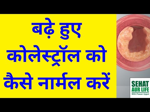 बढ़े हुए कोलेस्ट्रॉल को कैसे कम करें, How to Control High Cholesterol Levels