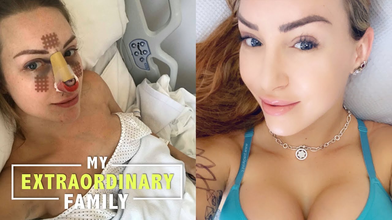 Revealing my next plastic surgery to my daughter - my extraordinary family