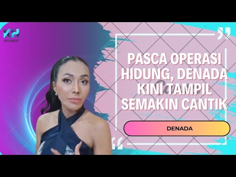 PASCA OPERASI HIDUNG, DENADA KINI TAMPIL SEMAKIN CANTIK