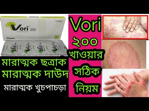 Vori 200 mg Tab Bangla।মারাত্মক ছত্রাক।  দাউদ,একজিমা। মারাত্মক চর্মরোগের  কার্যকরী ঔষধ। Vori 200 mg