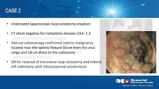 Robotic Intracorporeal Left Sided Colonic Anastomoses - Three Options Are Better Than One