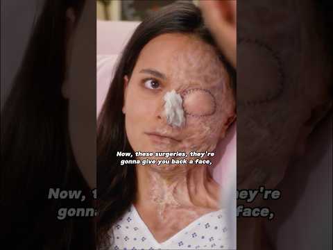 After four years and 43 surgeries, the doctor finally restored her face to health.#clips #tvshow