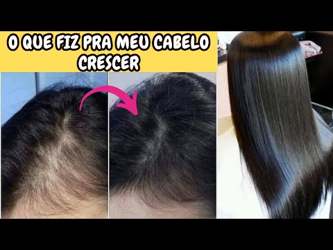 O QUE FIZ PARA MEU CABELO CRESCER RÁPIDO /DICAS DE PRODUTOS