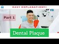 Dental Plaque and Biofilm Concepts