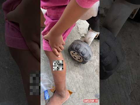 Kondisi setelah kena kenalpot #shorts #anakdesa #viral