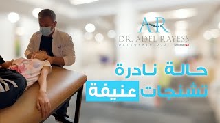 تشنجات عنيفة!! أصعب حالة يقوم بها الدكتور الريس في حياته المهنية...