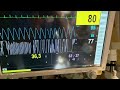 ビデオチュートリアルに基づくクイズ