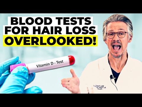 BLOOD TESTS FOR HAIR LOSS: THE CRITICAL BLOOD TESTS YOU NEED NOW!