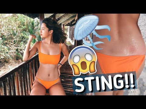 JELLYFISH IN SIARGAO (MASAKIT!!!) | Rei Germar