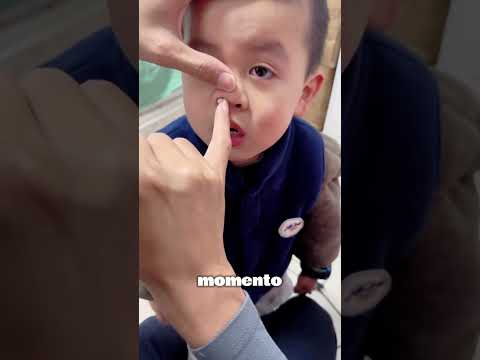 Mira la piedra se me quedó atascada en la nariz mientras jugabas #short