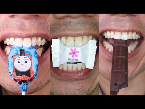 Satisfying Chewing ASMR #Compilation #ASMR #DoctorTristanPeh