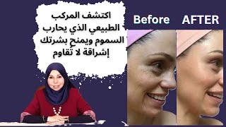 اكتشف المركب الطبيعي الذي يحارب السموم ويمنح بشرتك إشراقة لا تُقاوم