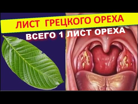 Что творит ЛИСТ ГРЕЦКОГО ОРЕХА . Лист ГРЕЦКОГО ОРЕХА ПОЛЬЗА