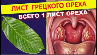 Что творит ЛИСТ ГРЕЦКОГО ОРЕХА . Лист ГРЕЦКОГО ОРЕХА ПОЛЬЗА