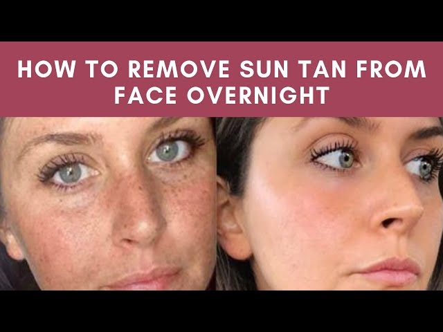 Download How To Remove Sun Tan From Your Face Quickly Remove Tan At Home Youtube Youtube Thumbnail Create Youtube remove sun tan from your face quickly