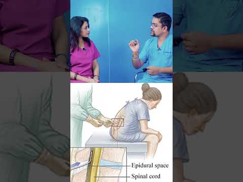 Epidural Benefits and Side Effects of Anesthesia During Labor | Dr. Sonal Parihar