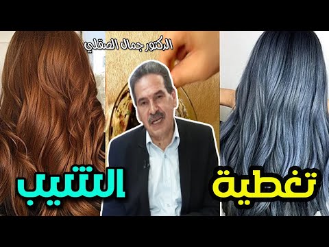 صبغ الشعر الأبيض وتغطيته بمكونات طبيعية و تلوينه بالأسود او البني - الدكتور جمال الصقلي -