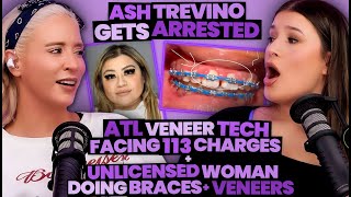 Ash Trevino ARRESTED + Veneer Tech Faces 113 Charges + Unlicensed Woman Offers $150 Braces (305)