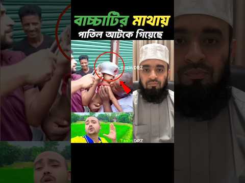 বাচ্চাটির মাথায় পাতিল আটকে গিয়েছে 😱 Mizanur Rahman Azhari #shorts #trending #mizah #islam