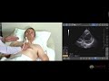 Cardiac POCUS Techniques and Challenges