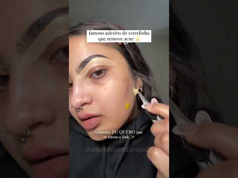 ACHEI O FAMOSO REMOVEDOR DE ESPINHAS  DAS BLOGUEIRAS E FAMOSAS ✨