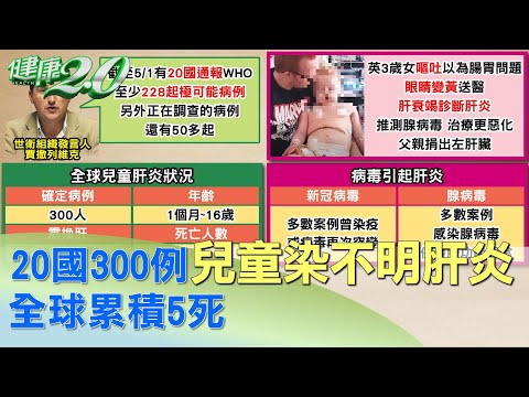 20國爆300例兒童染不明肝炎 全球累積5死 健康2.0