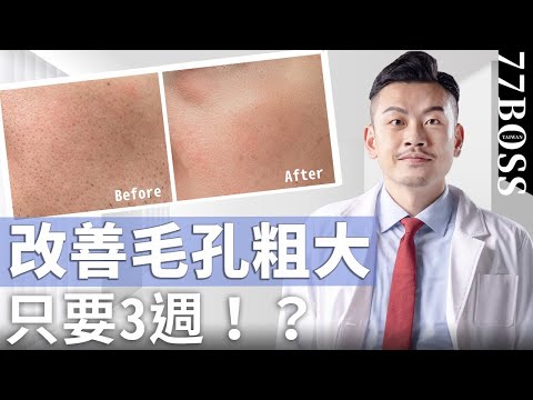 毛孔粗大、黑頭一堆？超有效必買保養品清單，21天效果好到哭！【77老大】