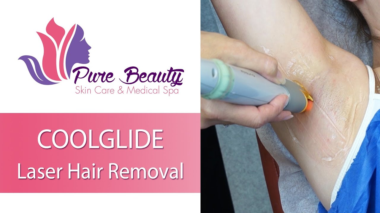 CoolGlide laser hair removal treatment at spa.