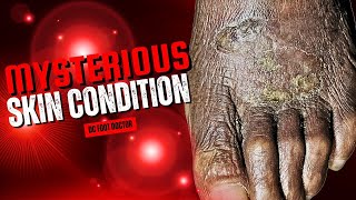 Mysterious Skin Condition