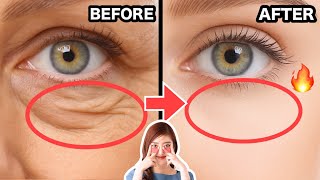 Eye Lifting Exercise & Massage for Eye Bags, Droopy Eyelids, Sunken Eyes, Wrinkles