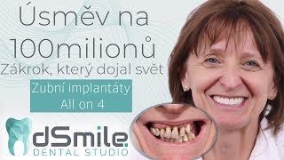 Nejslavnější úsměv v Česku – implantace All-on-4 v Praze