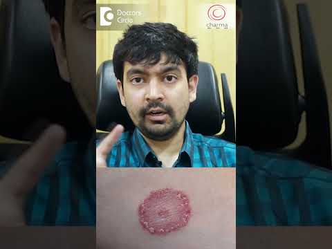 Treatment of Fungal Infection of Private Parts - Dr. Rajdeep Mysore | Doctors' Circle #shorts