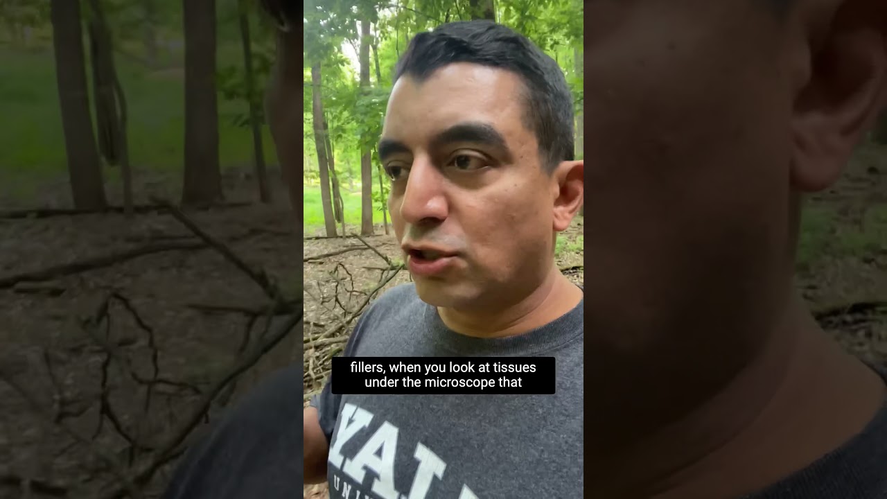 Person speaking in a forest about tissue fillers.