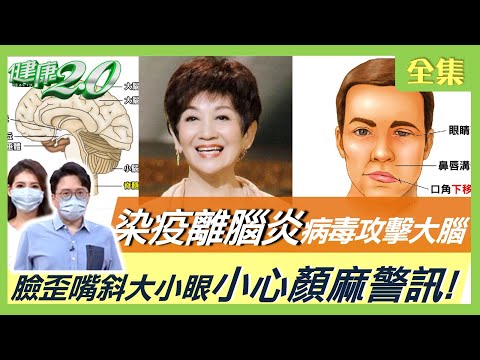 染疫抽蓄罹腦炎！病毒攻擊大腦 輕症恐慢性腦損傷？疫情下年輕人長皮蛇大增！中醫斬皮蛇清熱解毒！臉歪嘴斜大小眼 小心顏麻警訊！搶救面癱4穴位必學！健康2.0 20220514 (完整版)