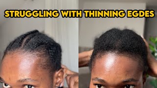 My Edges are Thinning Out !!! 🥺 | Here’s how I’m Regrowing Them
