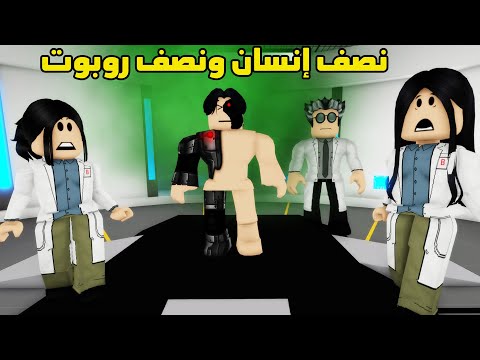 فيلم | أصبحت نصف إنسان ونصف روبوت