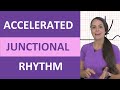 Accelerated Junctional Rhythm Concepts