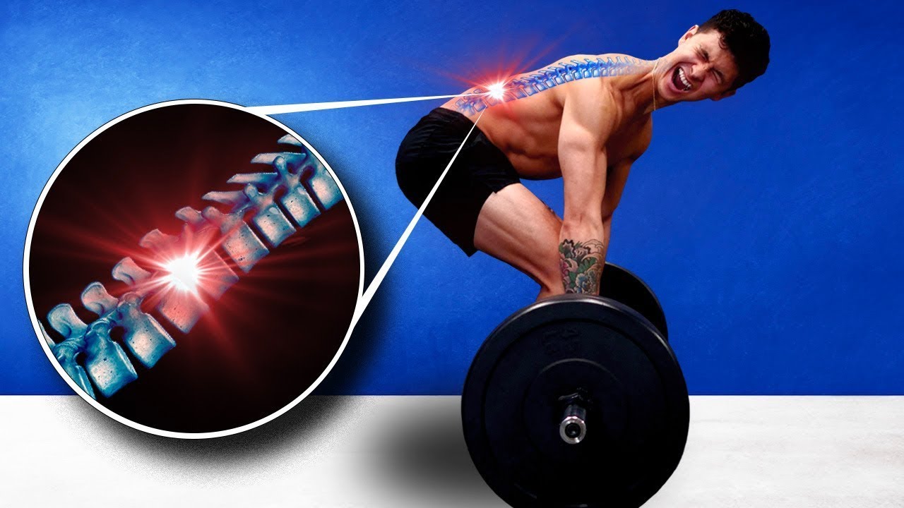 Deadlifts Hurt My Back (The 5 Reasons Why) ft. Dr. Stuart McGill
